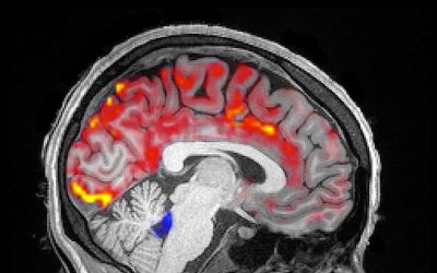 Ondas elétricas podem estar limpando seu cérebro enquanto você dorme