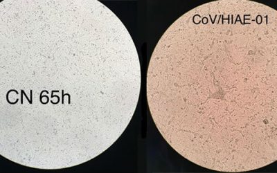 USP cultiva amostra de coronavírus em laboratório para distribuir à rede de saúde