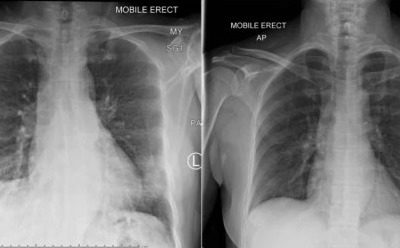 Australianos desvendam resposta do sistema imunológico ao Sars-CoV-2