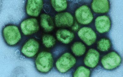 Estigmatizar a monkeypox, como ocorreu com o HIV/Aids, pode atrasar o diagnóstico