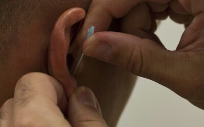Estudo confirma benefício da acupuntura auricular no tratamento da depressão