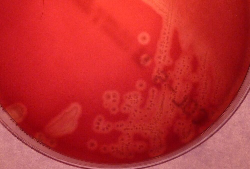 Abuso de antibióticos na pandemia quase quadruplica índice de resistência de bactéria perigosa para bebês