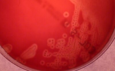 Abuso de antibióticos na pandemia quase quadruplica índice de resistência de bactéria perigosa para bebês